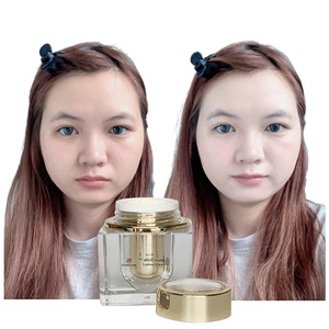 Meilleure crème blanchissante pour le corps chinois soins intensifs de la peau du visage coréen crème blanchissante rapide sans effets secondaires - Product Image 1
