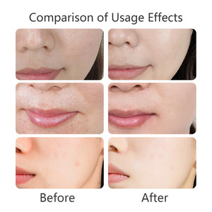 Limpiador <span class=keywords><strong>Facial</strong></span> en Gel-Mousse Orgánico Personalizado <span class=keywords><strong>de</strong></span> Fábrica: Hidratante, Humectante, No Reseca y Limpia en Profundidad - Product Image 5