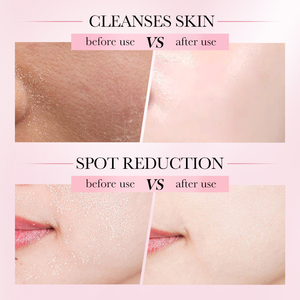 Crema para Ojos 4 en 1 de Fábrica OEM SADOER, Crema Facial Iluminadora con Hidrocotilo, Antienvejecimiento, Ingredientes Naturales, Set de Cuidado de la Piel - Product Image 5