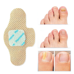 Patch de réparation d'ongles OEMODM, taille personnalisable, protection pour les soins des ongles des pieds - Product Image 4
