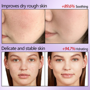 Mascarilla Facial Burbujeante con Extracto de Perilla y Agua Carbonatada, Hidratante, para Todo Tipo de Piel, Marca Privada OEM - Product Image 6