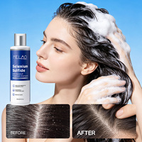 Champú Vegano con Ácido Hialurónico para el Control de la Caspa, Tratamiento Purificante del Cuero Cabelludo, Limpieza Profunda, Equilibrio de la Humedad, Cabello Saludable y Refrescante