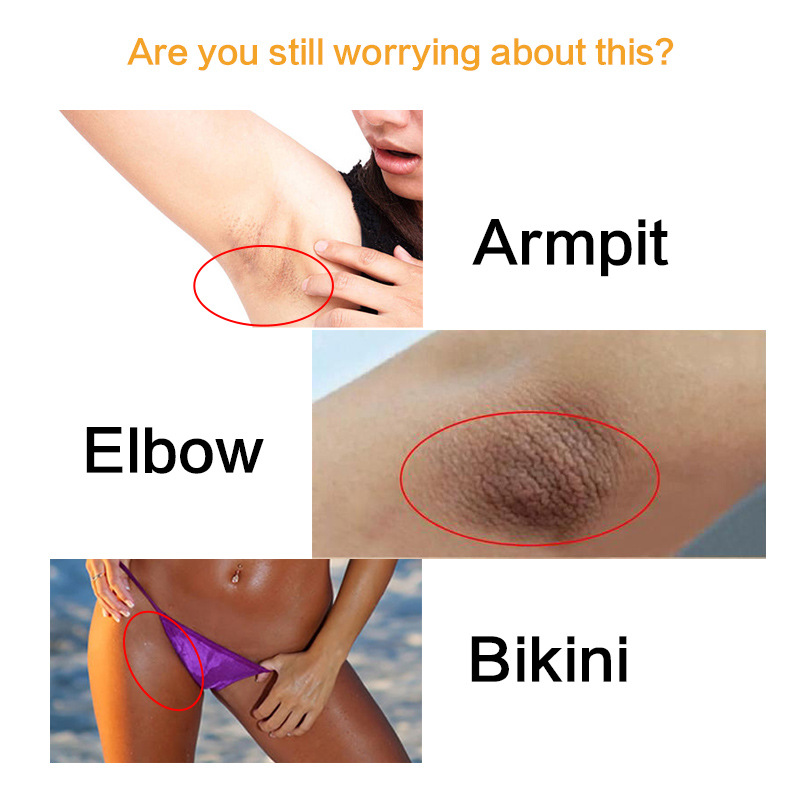 Body Underarm Whitening Cream Armpit Leg Knee Private Parts Brightening Melanin Remover Black Skin Whitening Cream