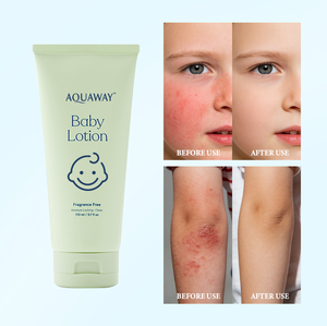 Crème hydratante pour le <span class=keywords><strong>visage</strong></span> et le corps des enfants, vegan, éclaircissante pour la peau, apaisante, hypoallergénique, adaptée aux peaux sensibles, crème contre l'eczéma pour bébé, utilisation quotidienne - Product Image 2