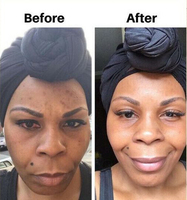 Sérum pour le visage éclaircissant à la vitamine C OEM, soin de la peau, sérum Piment Doux, sérum éclaircissant pour la peau, éclaircissant pour la peau noire