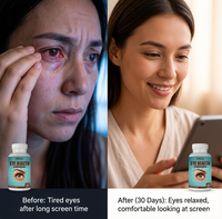 Lutéine 20mg : Vitamine pour les yeux, soutient la vision et filtre la lumière bleue pour soulager la fatigue oculaire – Gélules OEM sous marque privée pour adultes