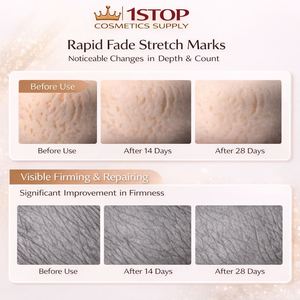 <span class=keywords><strong>Huile</strong></span> de Japonica pour la <span class=keywords><strong>grossesse</strong></span> en gros, crème <span class=keywords><strong>anti</strong></span>-vergetures pour femmes, fabricant de cosmétiques, approvisionnement direct - Product Image 2