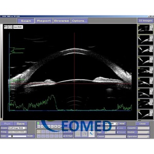 Équipement ophtalmique portable, bio-microscope à ultrasons ophtalmologique UBM à échelle complète, UBM3200S - Product Image 5