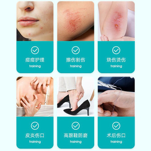 Pansement hydrocolloïde Cofoe 5,0x5,0 cm stérile, imperméable, pour le soin des plaies - Product Image 5