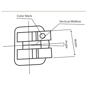 Professional Dental Brackets, Metal Braces, Rapid Correction of Dental Deformities - Product Image 6
