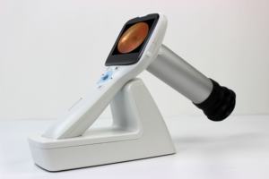 Çin ucuz taşınabilir olmayan midriatik <span class=keywords><strong>Retinal</strong></span> kamera fiyat Optomed el mobil Fundus kamera - Product Image 6