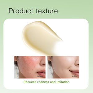 <span class=keywords><strong>Crema</strong></span> Idratante Premium <span class=keywords><strong>Lenitiva</strong></span> e Riparatrice per Pelli Sensibili con <span class=keywords><strong>Calendula</strong></span> Nutriente e Idratante - Product Image 5