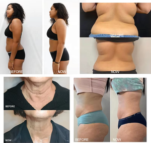 Système Cryothérapeutique Professionnel avec Technologie d'Analyse Cutanée pour des Traitements de Beauté Personnalisés du Visage et du Corps - Product Image 5