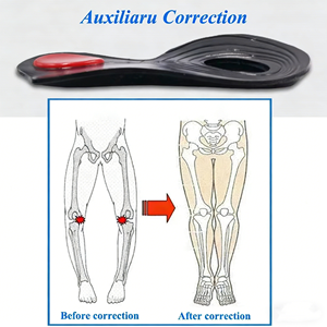 <strong>Orthopedic</strong> Insoles Arch Correction Flat Feet Deep Cup Soft Gel Cushion Insert Heel Pain Relief Daily Shoes Comfort - Product Image 4