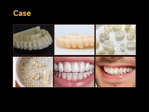 Độ tinh khiết cao nhiều ngôn ngữ Zirconium thiêu kết lò điện cho <span class=keywords><strong>CAD</strong></span>/<span class=keywords><strong>Cam</strong></span> thiết bị phòng thí nghiệm nha khoa lò thiêu kết lò - Product Image 5