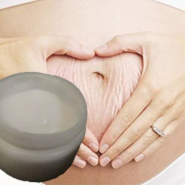 Krim Pemutih Penghilang Stretch Mark Semua Tipe Kulit