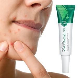 LAIKOU 20g Gel anti-acné à l'aloe vera pour le soin du visage, contrôle du sébum et élimination des boutons, marque privée - Product Image 1