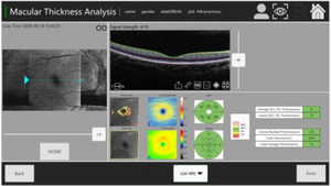 Tomografía de Coherencia Ó<span class=keywords><strong>ptica</strong></span> OCT-500 de Alta Precisión y Tecnología Avanzada, Mejor Precio, Gran Venta - Product Image 2