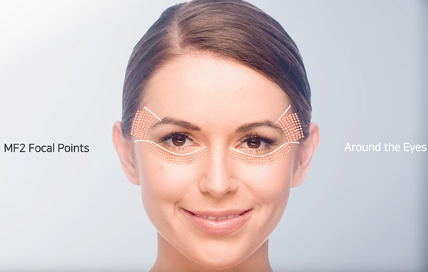 新设计 hifu vmax 皱纹减少面部提升抗衰老美容机