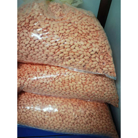 Comprimés de Vitamine C Liposomale Superaliment Santé Acide Ascorbique Compléments pour le Système Immunitaire pour Adultes et Femmes Enceintes