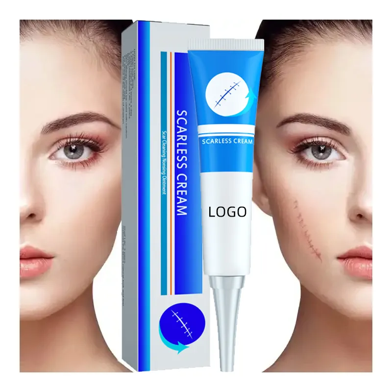 OEM Custom Best Scar Cream Natural Organic Ingredient Treatment Skincare Scar Removal Cream Heal And Reduce Scars