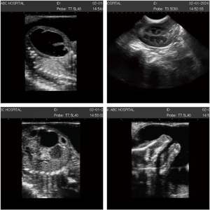 Dokter Hewan <span class=keywords><strong>Ultrasound</strong></span> portabel dokter hewan genggam nirkabel Probe <span class=keywords><strong>Ultrasound</strong></span> untuk penggunaan pertanian klinik hewan peliharaan - Product Image 2