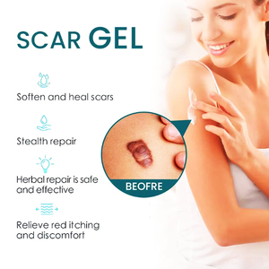 Crème Réparatrice pour Agents de Soins de Santé, <span class=keywords><strong>Pommade</strong></span> Éclaircissante, Gel de Compresse Froide, Crème Réparatrice Lissante pour Cicatrices, Gel Éliminateur de Cicatrices - Product Image 3