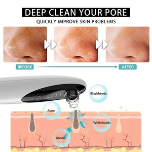 Trực Quan Facial Chân Không Off Remover Với Máy Ảnh Extractor Công Cụ Mụn Trứng Cá Lỗ Chân Lông Sạch Nhìn Thấy Đầu Đen Loại Bỏ Chân Không - Product Image 4
