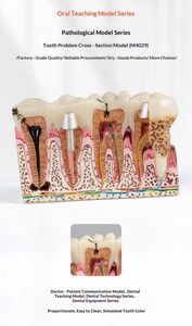 Modelo de Patología Dental, Modelo de Comunicación Paciente-Doctor, Modelo de Enseñanza de Salud Bucal, Resina - Product Image 5