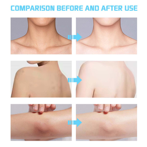 Sapone Premium al Latte Nutriente Antirughe Equilibrante Idratante Rassodante Fatto a Mano Sbiancante con Vitamina C per Pelle Spenta - Product Image 4