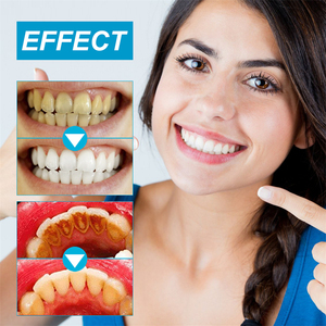 Poudre blanchissante pour les dents West Month au bicarbonate <span class=keywords><strong>de</strong></span> <span class=keywords><strong>soude</strong></span>, élimination des taches, éclaircissement, protection des gencives, élimination <span class=keywords><strong>de</strong></span> la mauvaise haleine - Product Image 3