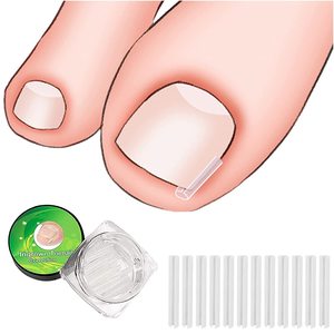 10 pièces/boîte C forme <span class=keywords><strong>ongle</strong></span> <span class=keywords><strong>incarné</strong></span> Correction Liner pédicure outil traitement des ongles accepter la personnalisation - Product Image 2