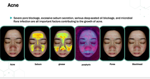 Analyseur de peau portable avec écran de 15,6 pouces, scanner facial, machine d'analyse de la peau X5, analyseur de peau intelligent, analyse d'image de la peau 3D - Product Image 4