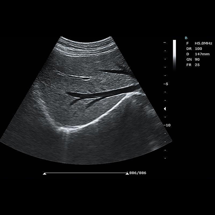 Máquina de ultrasonido Doppler en color para diagnóstico médico con diseño nuevo de 2022
