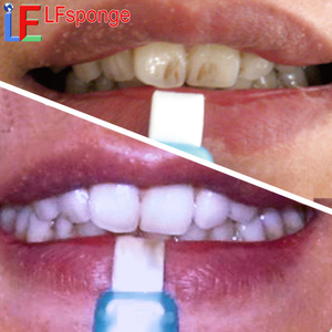 Nụ cười tươi sáng không Peroxide răng Làm sạch Bộ dụng cụ tư nhân logo nhà tự nhiên làm sạch răng Làm sạch Kit - Product Image 6