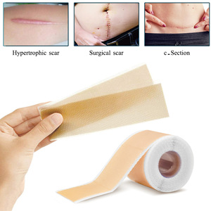 Patchs cicatriciels en silicone confortables de marque privée et ruban cicatriciel pour le retrait des cicatrices, fournitures de thérapie de rééducation - Product Image 3