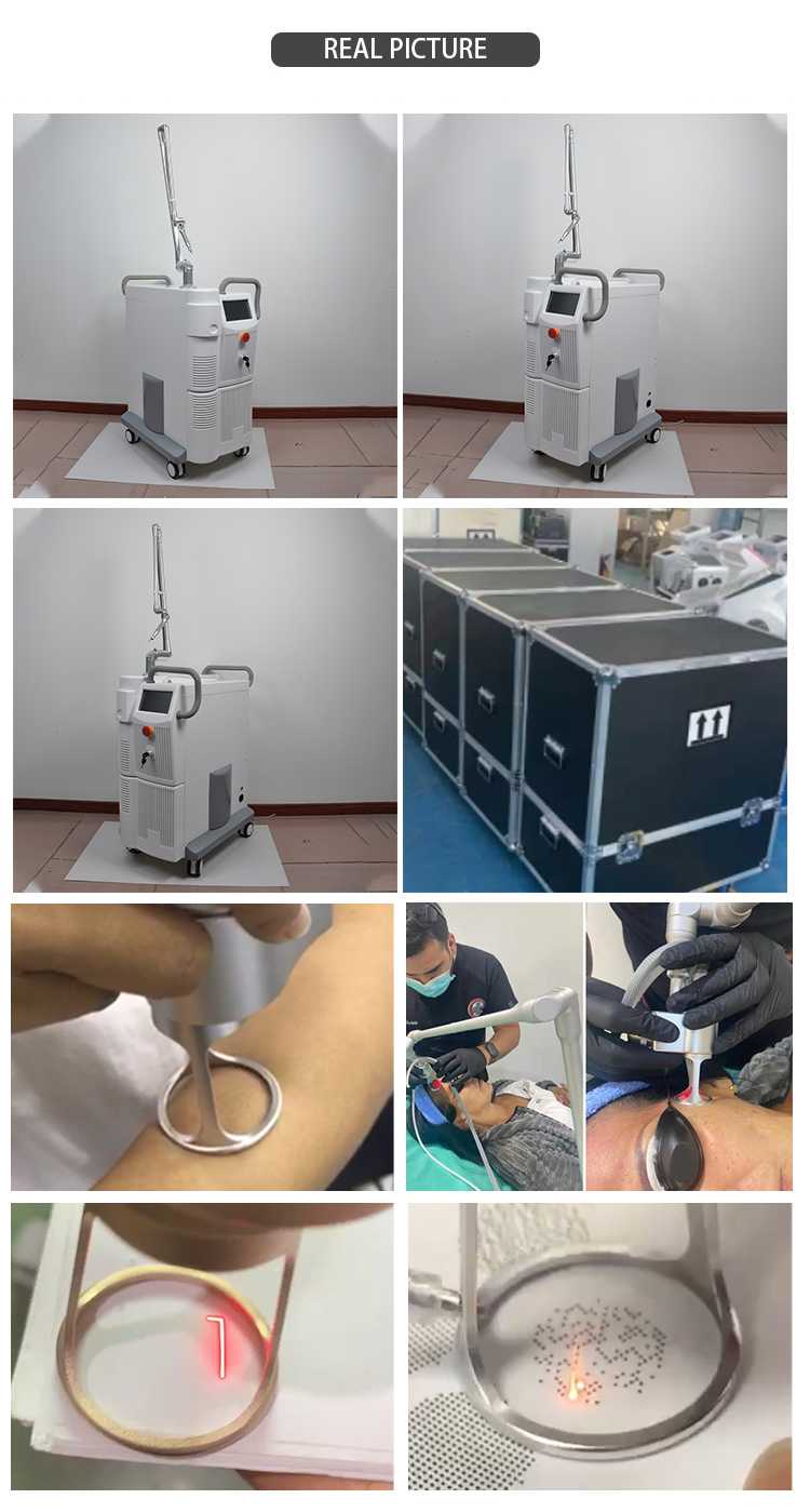 Wholesale Portable Scar removal Laser Equipment home use Rejuvenation Vaginal Co2 Fractional Laser CO2 For Pigment Removal