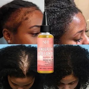 Özel etiket doğal honhonbatana Alma saç yağı Anti kayıp Regrowth tedavi derisi çemen süper 5X Batana saç büyüme yağı