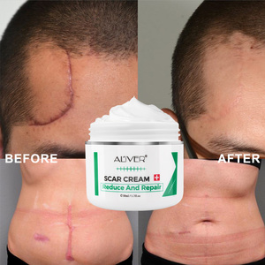 Crème pour le visage Aliver, crème pour éliminer les cicatrices, pour améliorer les cicatrices de brûlures, réduire la pigmentation, améliorer les cicatrices d'acné - Product Image 6