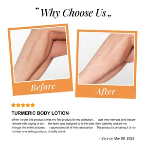 Skin Care Products Turmeric Whitening Dark Spots Removal Body Lotion Private Label Natural Customized For Women Dark Skin Adults