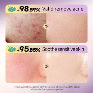 Patchs Hydrocolloï<span class=keywords><strong>des</strong></span> Cœur d'Étoile pour l'Acné à l'Acide Salicylique – 72 Patchs par Boîte pour le Visage, Tous Types <span class=keywords><strong>de</strong></span> Peau – Absorbe les Sécrétions Cutanées - Product Image 4