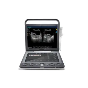 सबसे सस्ता पोर्टेबल ट्राली चिकित्सा रंग डॉपलर Sonoscape 4d अल्ट्रासाउंड मशीन की कीमत के लिए भौतिक चिकित्सा अल्ट्रासाउंड
