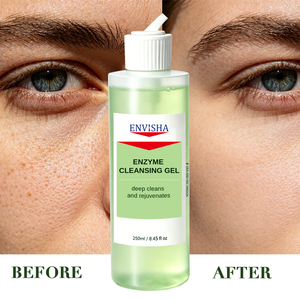 <span class=keywords><strong>Gel</strong></span> <span class=keywords><strong>Nettoyant</strong></span> Quotidien Enzymatique pour le Visage à l'Extrait Végétal, Rafraîchissant, Resserre les Pores, Élimine l'Excès de Sébum et Nourrit la <span class=keywords><strong>Peau</strong></span> - Vente en Gros - Product Image 2