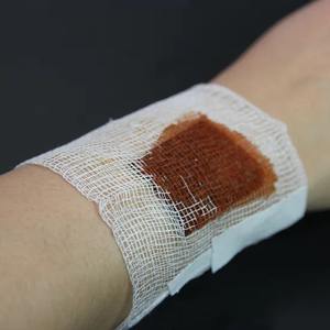 Compressa de Esponja Médica Detectável por Raios-X, 4, 8, 12 e 16 Camadas, com Borda Desdobrável - Product Image 3