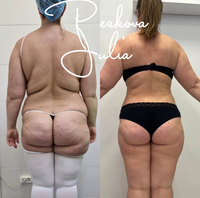 Appareil amincissant le corps élimination des graisses 980 nm Diode Laser Lipomes Machine de beauté Laser Ablation Ultrasonique 1470 Liposuccion Machine