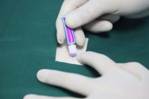 StarSpeed cerrahi tutkal 0.5ml 1ml ampul ambalaj kesimler için - Product Image 5
