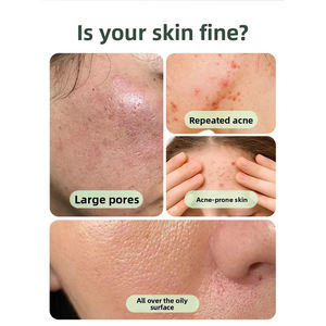 เซรั่มกรดซาลิไซลิกรอยสิวบนใบหน้าสำหรับ<span class=keywords><strong>การ</strong></span>ทำทรีตเมนต์การซีดจาง - Product Image 4