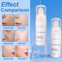Mousse Nettoyante Visage Douce Contrôle Sébum OEM ODM – Rafraîchissante, Hydratante, Nettoyage Facial en Profondeur