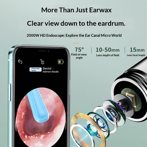 Nuevo Limpiador Visual de Cera para Oídos 2026 con Cámara, Endoscopio Seguro para Eliminar Cera con Cámara de 5MP, Otoscopio Luminoso para Oídos - Product Image 6