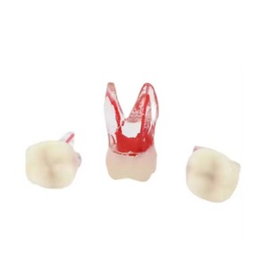 Медицинская Стоматологическая эндодонтическая модель для лечения корневых каналов - Product Image 6